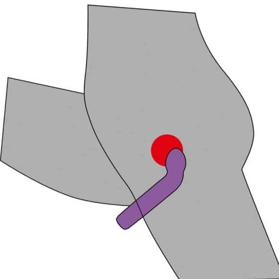 Kje je G spot